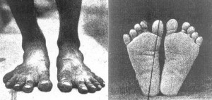 pies de hombre descalzo