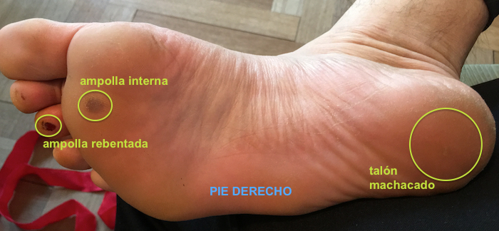 pie derecho.jpg