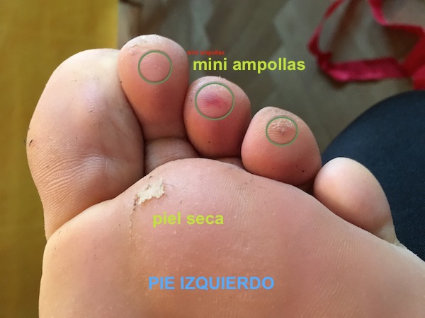 pie izquierdo.jpg