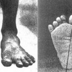 pies de hombre descalzo