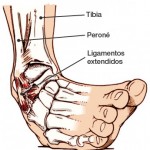 esguinces de tobillo anatomía