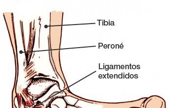 esguinces de tobillo anatomía