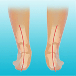 Movimiento de pronación en el pie