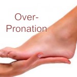 over-pronation-110225102727-phpapp02-thumbnail-4
