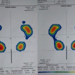 presiones con y sin calzado minimalista